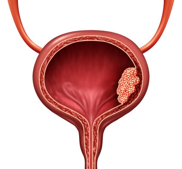 Urological cancers