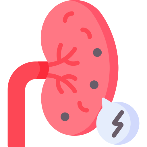 Kidney Stones