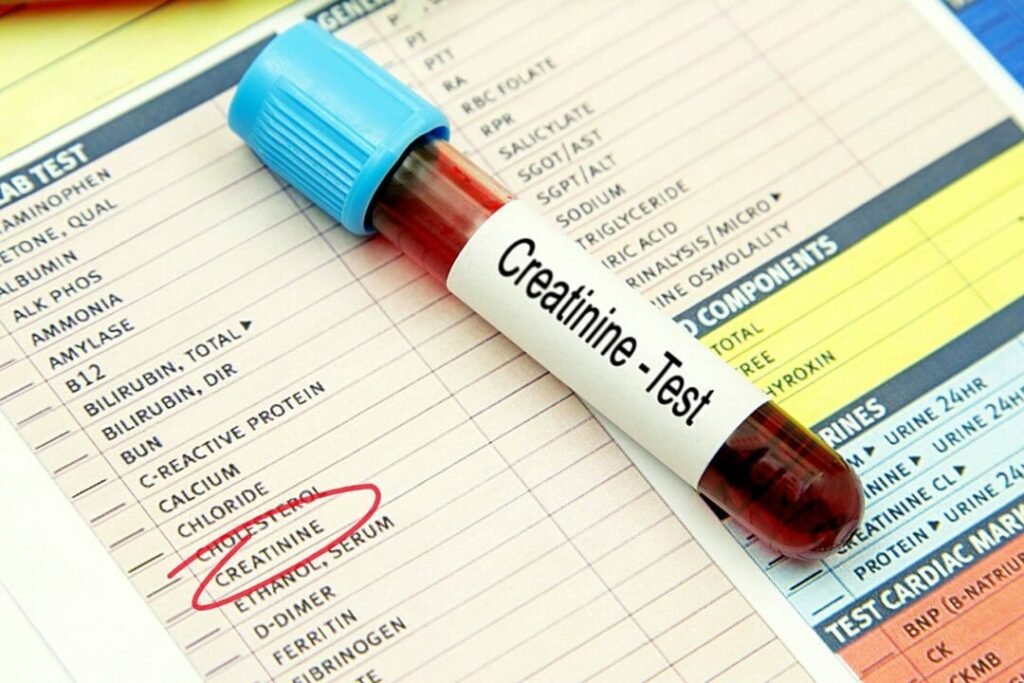 What is Serum Creatinine ?